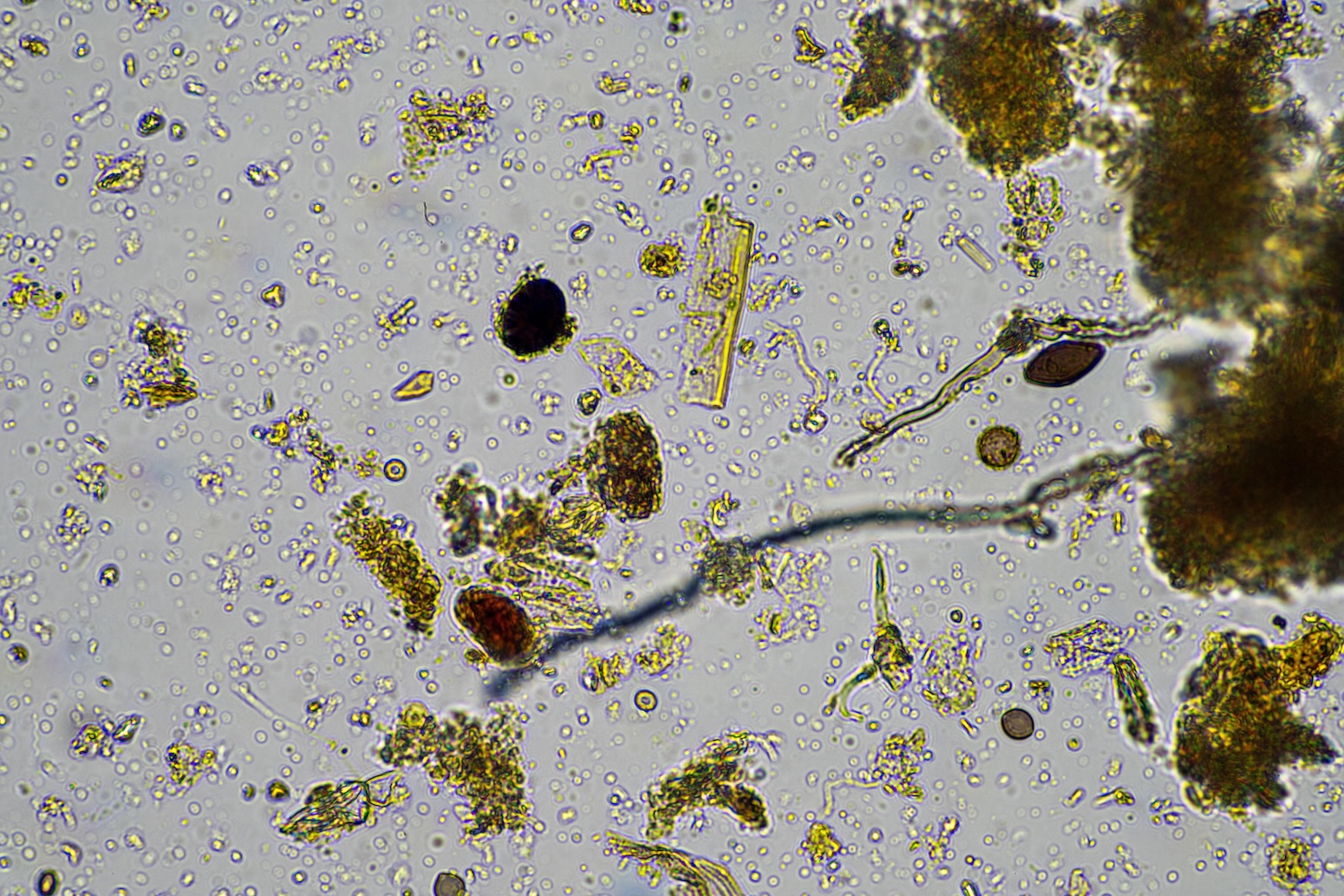 Soil microorganisms, including amoeba, fungi and funga, from a regenerative agriculture farm in Australia, seen with a microscope.